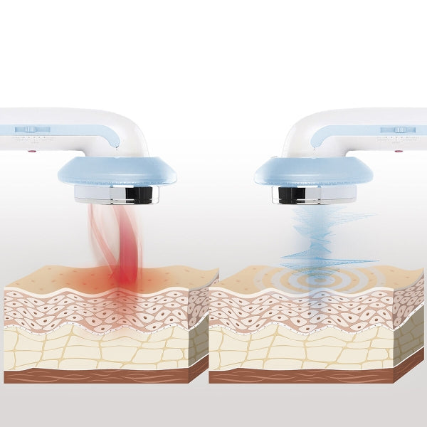 CellyMax 3-in-1 Ultrasone Anti-Cellulitis: Infrarood & EMS